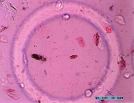 Sediment urinar rare epitelii plate rar mucus